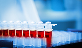 Blood Testing in Pembroke Pines, FL