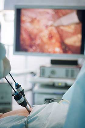 Gallbladder Removal Surgery in Ho Ho Kus, NJ