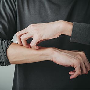 Granuloma Annulare Treatment in Fort Myers, FL