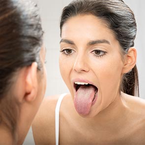 White Tongue Treatment in Bristol, VA