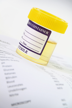 Urinalysis Testing in Brookhaven, MS